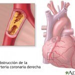 altos-trigliceridos